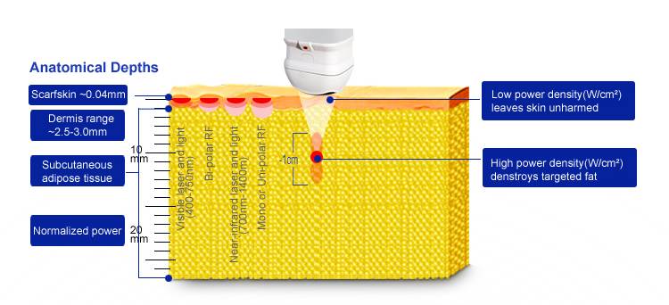 Different depth of 4D Hifu cartridges