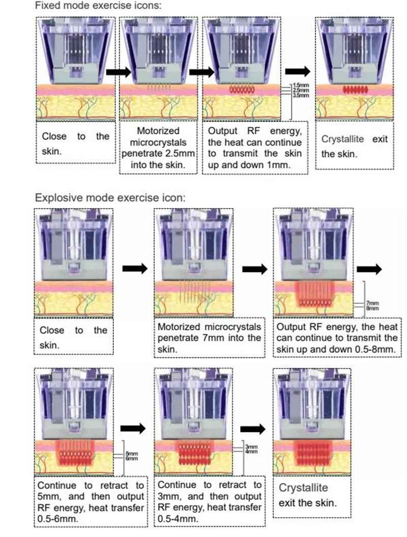 how does Morpheus 8 Microneedling Machine work