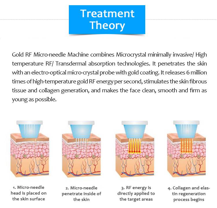 Working principle of Rf Microneedling Machine