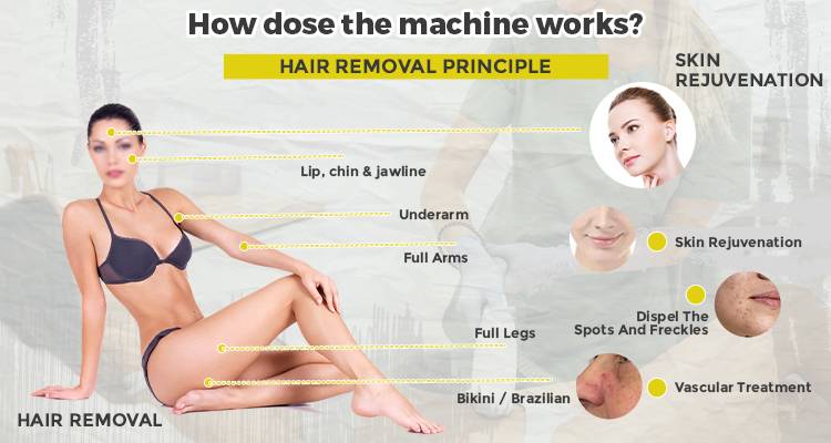 What problems can Ipl Laser Hair Removal Machine solve