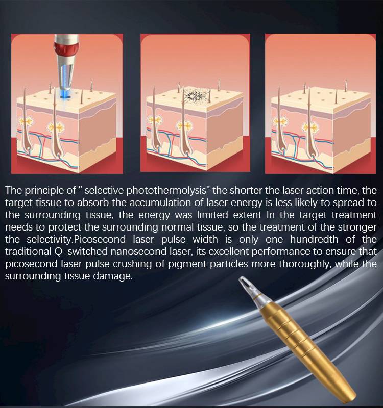 working theory of Nd Yag Laser Machine