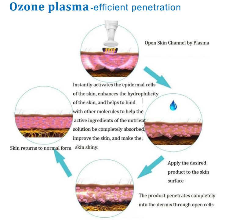 Ozone Plasma Pen Treatment