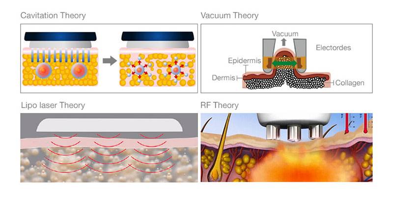 working theory of 40k Cavitation Machine