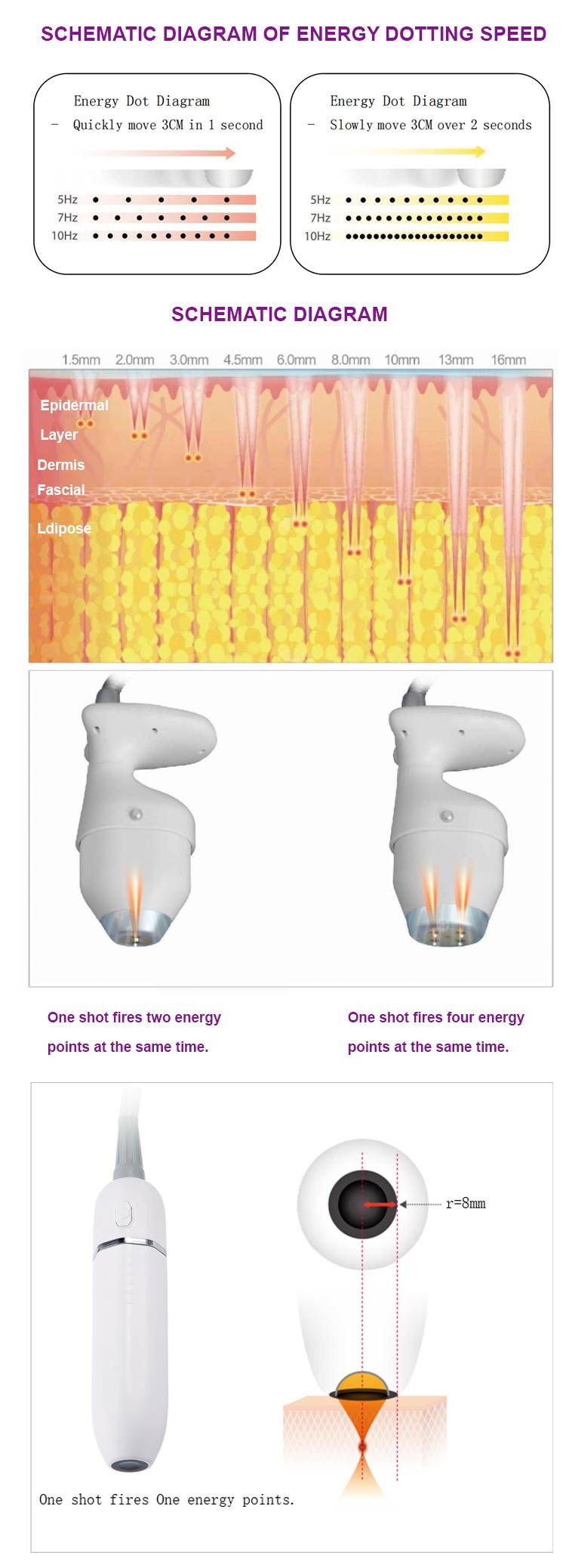 working theory of Ice Hifu