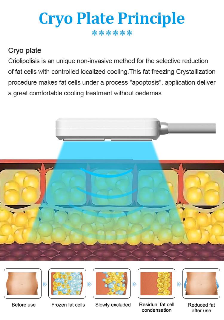 woking theory of Cryo Ems Machine