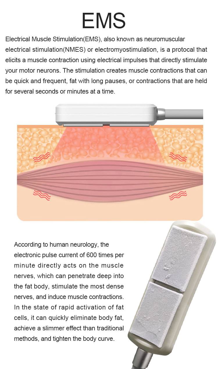 ems working theory of Cryo Ems Machine