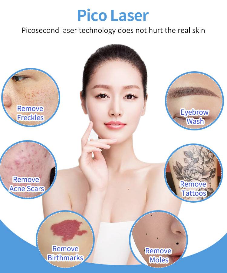 what problems can Picosure Tattoo Removal Machine solve