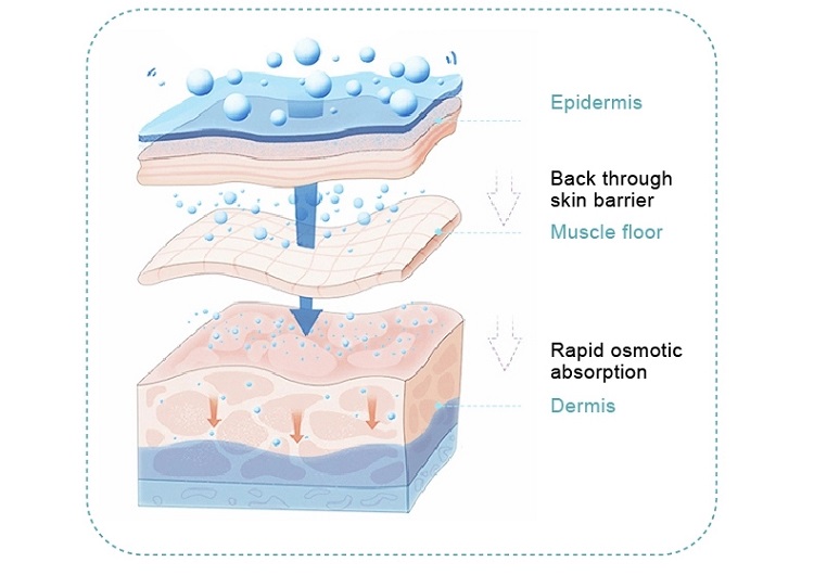 How does Needle Free Mesotherapy work